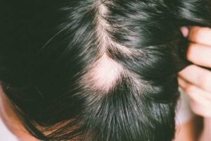 Role of PTD-DBM and GHK-Cu in Stimulating Hair Growth